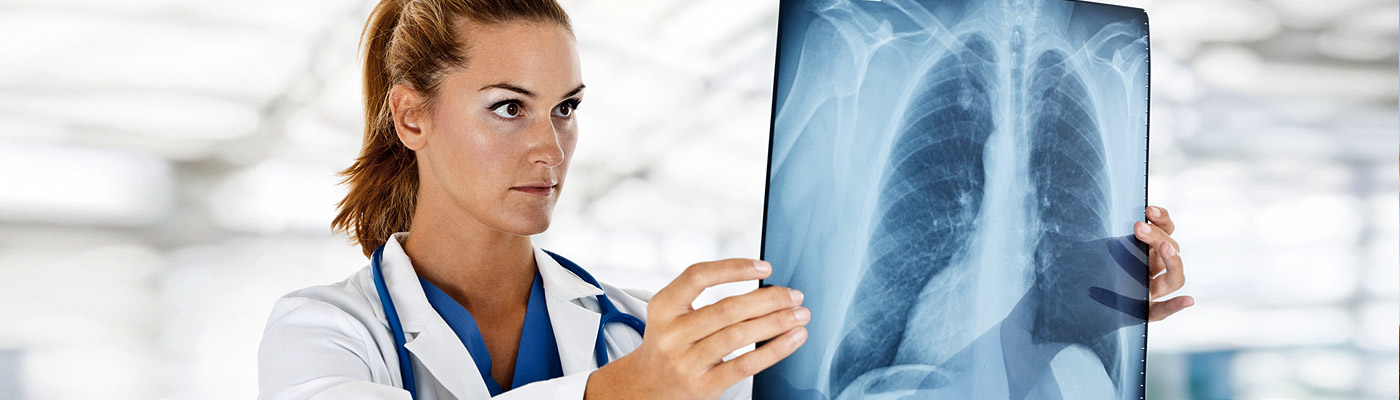 Eine Ärztin betrachtet ein Röntgenbild der Lunge.